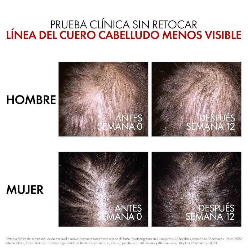 Vichy Dercos Aminexil Booster Anticaída 90 ml - Efecto Rápido