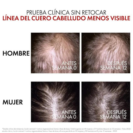 Vichy Dercos Aminexil Booster Anticaída 90 ml - Efecto Rápido